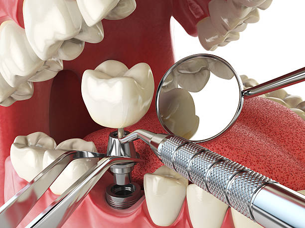 Best Walk-In Emergency Dentist in Malvern, IA
