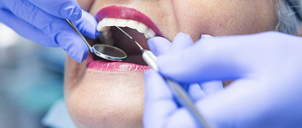 Best Emergency Broken Tooth Repair in Malvern, IA